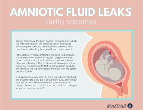 how do you know if your leaking amniotic fluid|Leaking amniotic fluid (premature rupture。